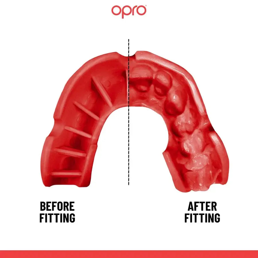 Silver Level Black Mouthguard - Gen 4 - MASA