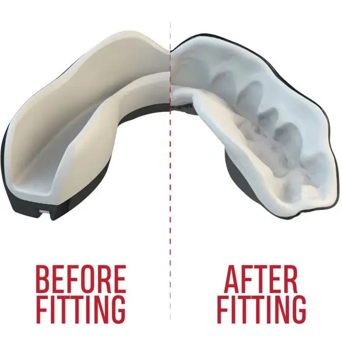 SAFEJAWZ Mouth guard “Extro” - MASA